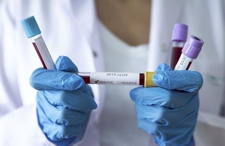 Минздрав направит в Житомир тест-системы для обнаружения коронавируса